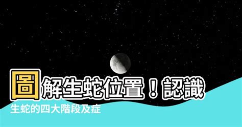 生蛇位置圖|生蛇症狀、成因、一文睇清 醫生解釋傳播風險